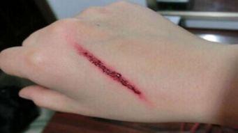 吃茭瓜能愈合伤口吗视频,揭秘其愈合伤口的惊人秘密